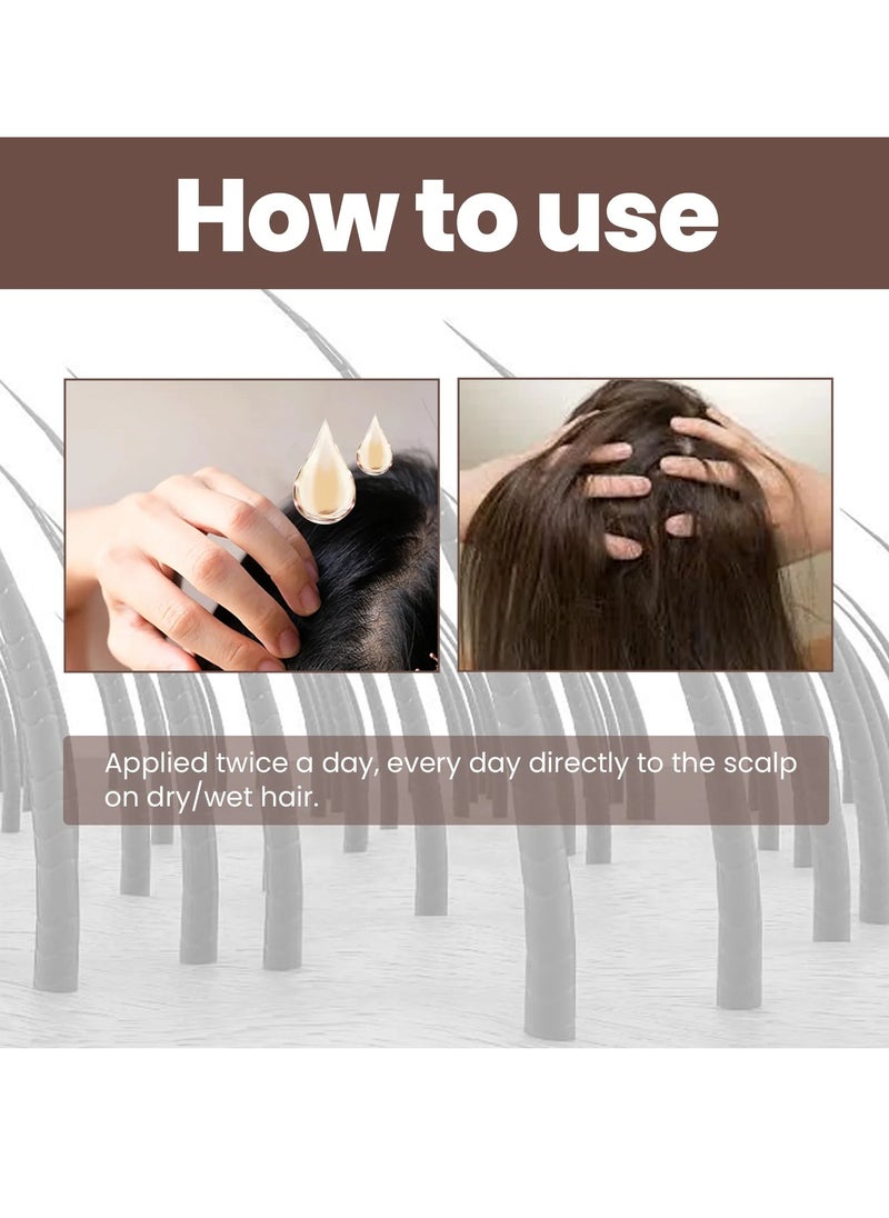 EELHOE - Fast Growth Hair Serum, Anti Hair Loss Hair Treatment Oil, Scalp Cure Nourish Strong Hair Roots Essence Oil, Effective Hair Regrowth Essential Oil For Damaged And Frizzy Hair - Image 1