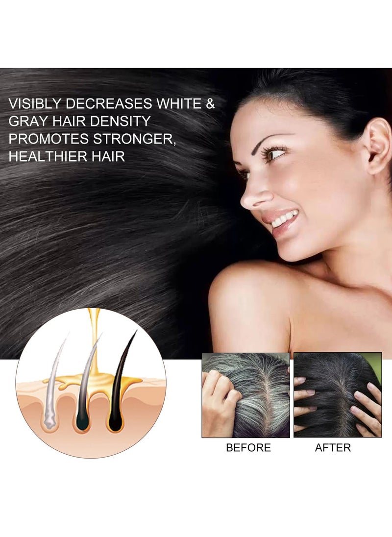 EELHOE - Fast Growth Hair Serum, Anti Hair Loss Hair Treatment Oil, Scalp Cure Nourish Strong Hair Roots Essence Oil, Effective Hair Regrowth Essential Oil For Damaged And Frizzy Hair - Image 1