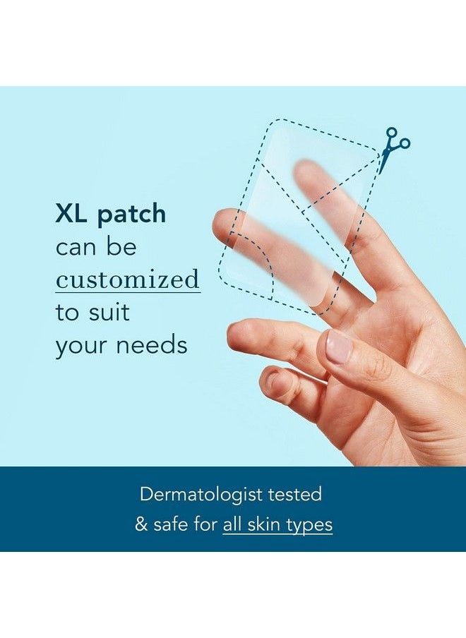 Rael - Pimple Patches Miracle Xl Spot Control Cover Hydrocolloid Acne Patches For Face Zit And Blemish Spot Back And Body For All Skin Types Vegan Cruelty Free (6 Count) - Image 1