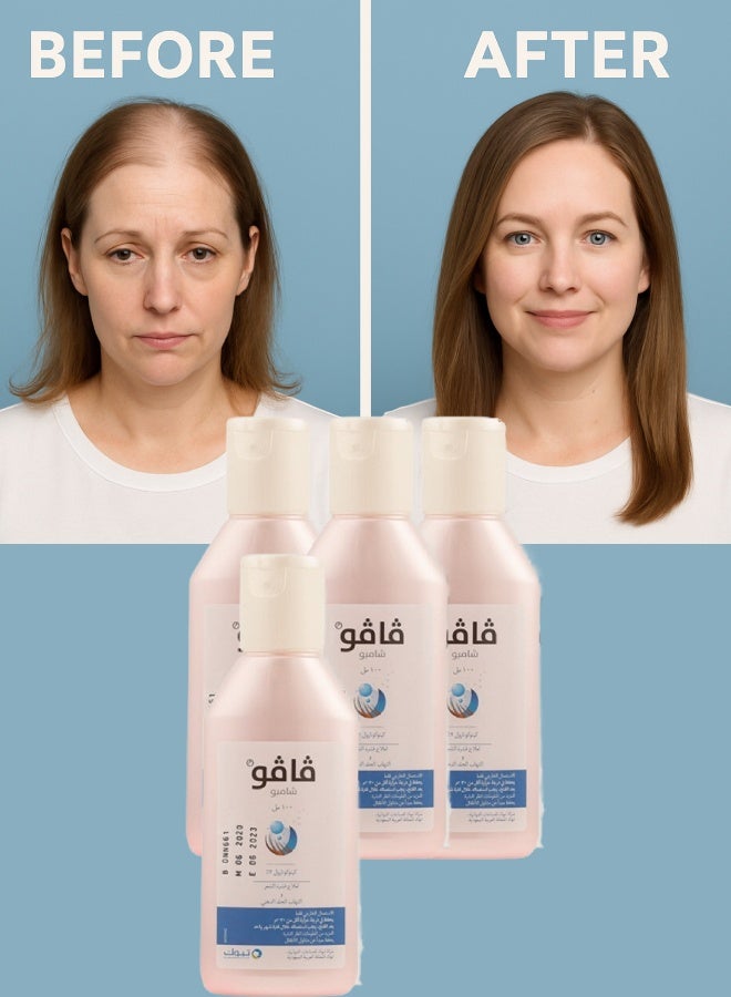 فافو 4 قطع فافو 2% شامبو 100مل - Image 1