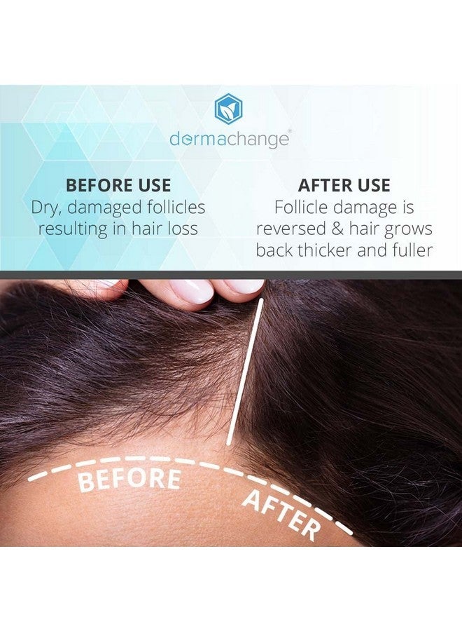 dermachange Hair Growth Shampoo for Thinning Hair and Hair Loss - Volumizing and Thickening Sulfate-Free Formula for Men and Women - Enhances Shine and Body for Color-Treated Hair with Aloe Vera (8oz) - Image 4