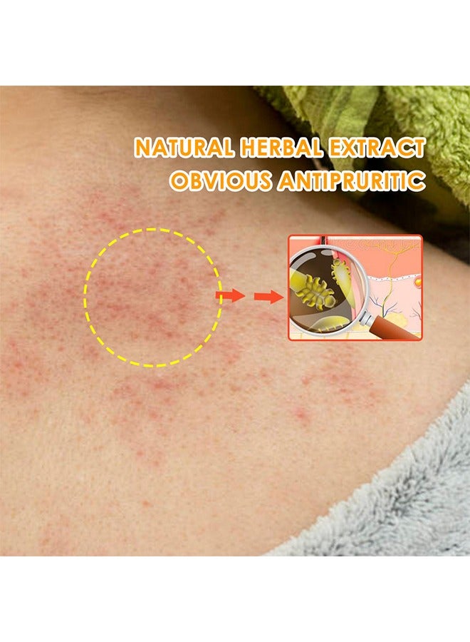 سوميفون كريم بصيلات الشعر ، بصيلات شعر فروة الرأس وبصيلات الشعر مع حب الشباب ، علاج الوجه والجسم ، علاج حب الشباب الكيسي الطبيعي ، كريم بصيلات الشعر الممتاز ومزيل البثور - 20 جم - Image 5