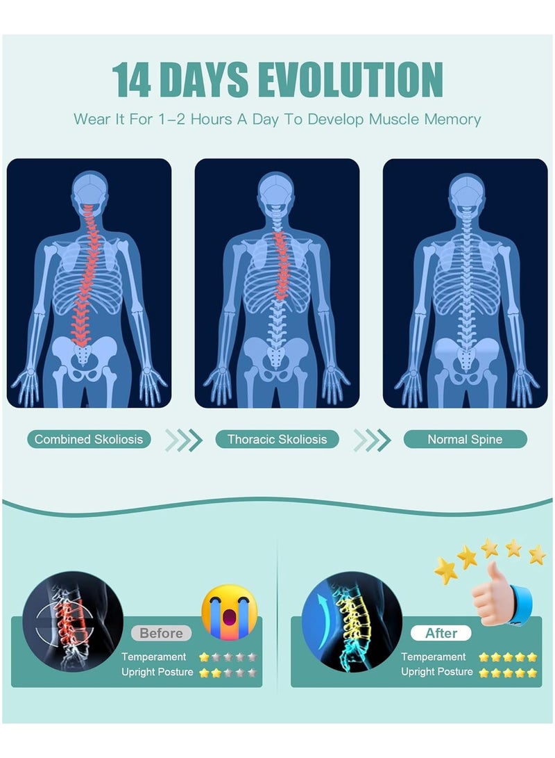 Back Brace Posture Corrector for Women and Men - Full Back Support for Improving Posture & Correcting Scoliosis Hunchback for Soothing Upper and Lower Back Lumbar Neck Shoulder Discomfort (Size:XL) - Image 5