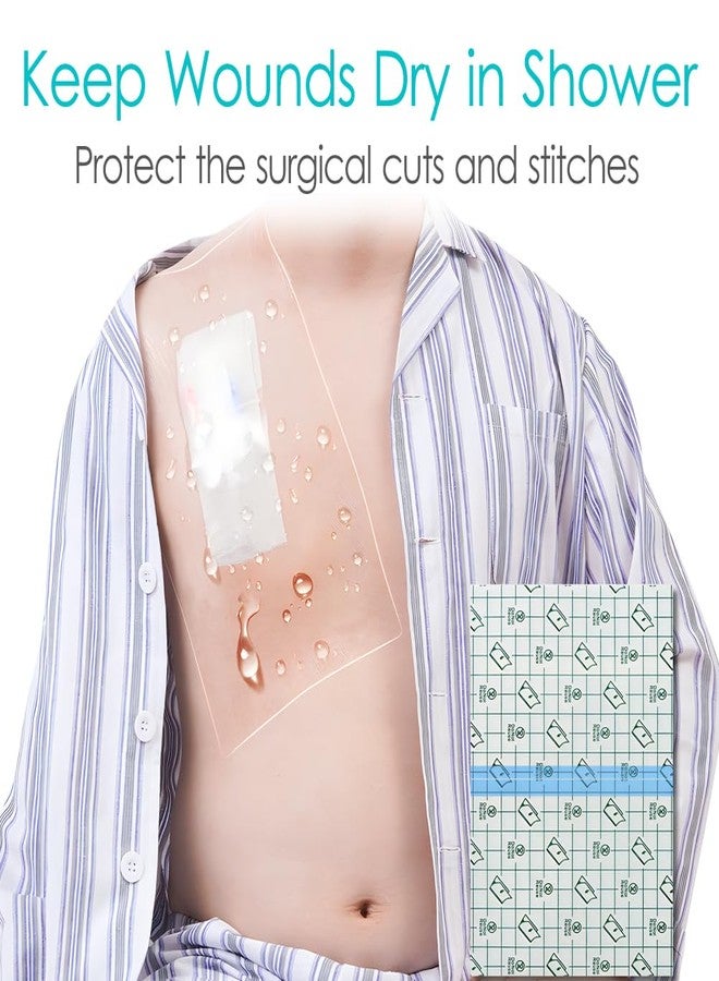 DiaBelt غطاء استحمام مقاوم للماء لقسطرة غسيل الكلى، واقيات تغطية كبيرة لملحقات منفذ غسيل الكلى البريتوني، قسطرة الصدر PD، خط PICC المركزي، أنبوب التغذية 10 بوصة × 12 بوصة (عبوة من 25 قطعة) - Image 2