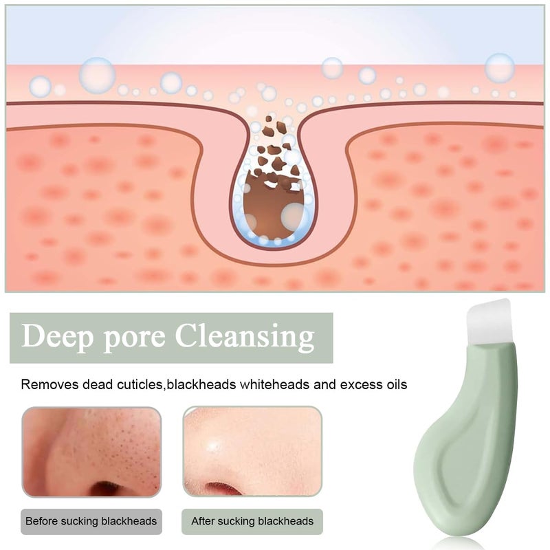 M'AYCREATE MAYCREATE® Blackhead Removal Tool, Silicone Face Scrubber Black Head Remover for Deep Cleansing, Face Scraper Nose Blackheads Skin Care Tool for Men Women Pore Cleaning, Acne, Whitehead, Comedones - Image 4