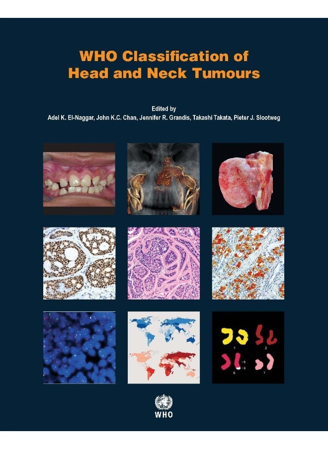 WHO classification of head and neck tumours 
