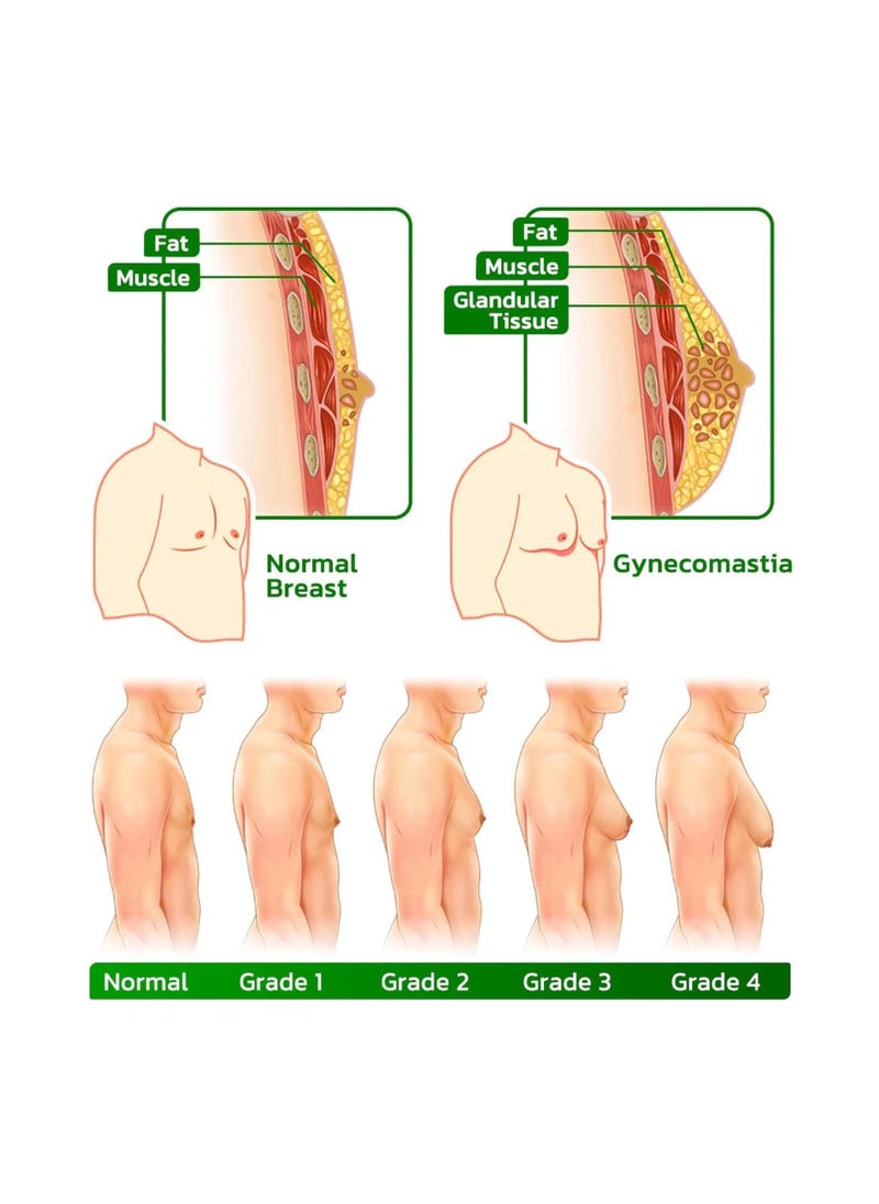 SYOSI - Turmericmax Gynecomastia Chest Compression Patch, Men's Gynecomastia Firming Ginger Patch,  Tightening Chest Muscles with Natural Ingredients, Shrinks Men Chest Tightening Ginger Patch (2 Set) - Image 1