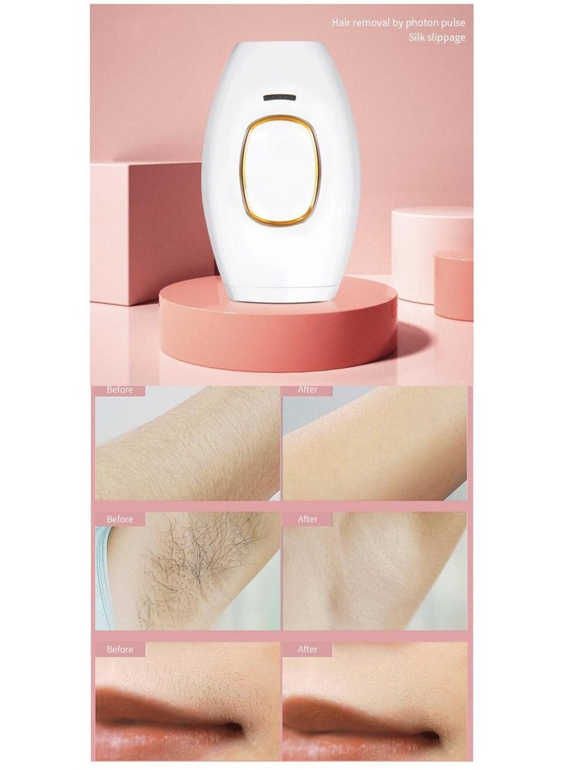 NIBEMINENT IPL Intelligent Laser Hair Removal System - Image 4