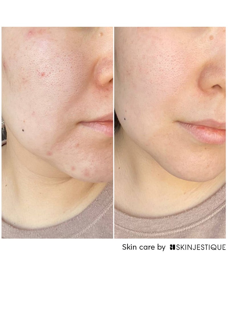 Micro-peel glow serum