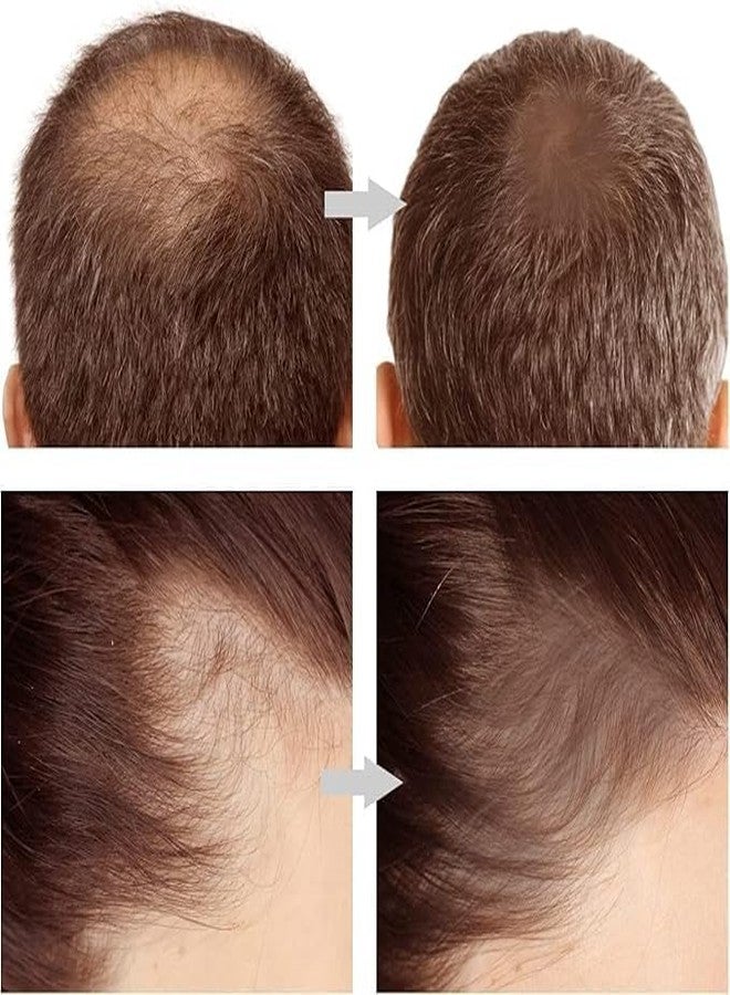 VALKYRIE Natural Hairline Powder, Hair Shading Sponge Pen, Hairline Shadow Powder Stick, Quick Hair Root Touch-Up, Eyebrow Stamp (Black, 100 Gram) - Image 4