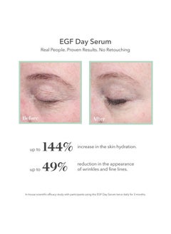 Bioeffect BIOEFFECT EGF Day Serum with Hyaluronic Acid and Natural Barley Growth Factor, Oil-Free Wrinkle Serum for Face, Boosts Hydration, Firming, Refines Pores, Smooths Skin Texture for All Skin Types  - Image 2