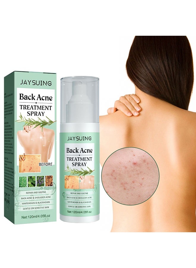 Jaysuing Back Acne Treatment Spray , Lighten Acne Marks Repair Back Shoulder Acne Skin,2% Salicylic Acid And Tea Tree Oil Spray 120ml - Image 1