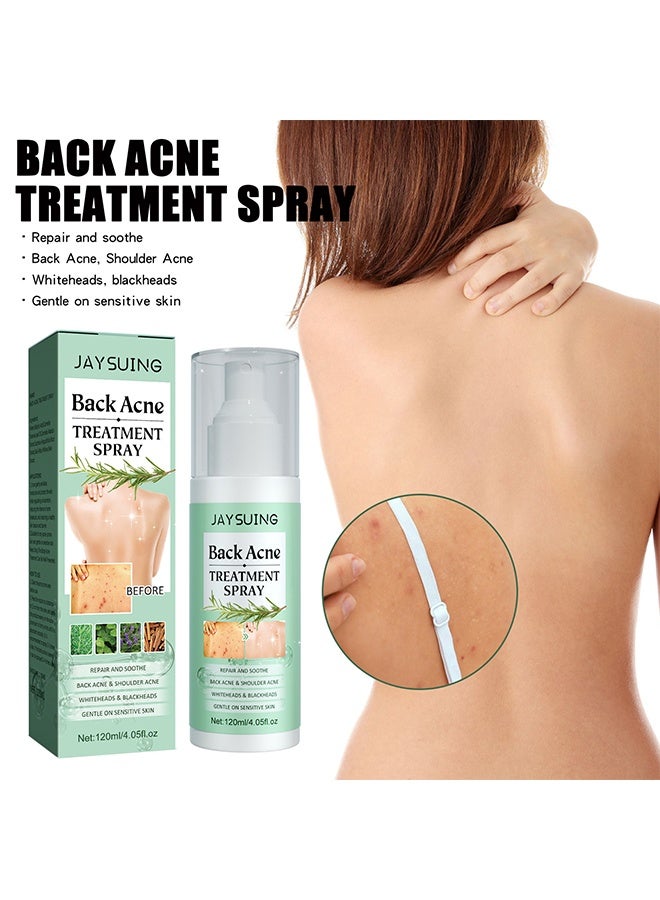 Jaysuing Back Acne Treatment Spray , Lighten Acne Marks Repair Back Shoulder Acne Skin,2% Salicylic Acid And Tea Tree Oil Spray 120ml - Image 2