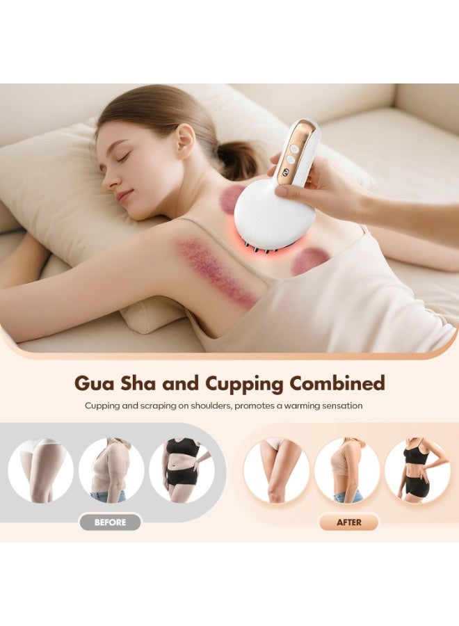 Arabest Angju Lymphatic Drainage Massager & Anti Cellulite Massage Tool,New Smart Cupping Massager,Helps Reduce Stretch Marks & Cellulite，for Belly, Arms & Legs,Body Sculpting Machine with Heat & Vibration - Image 4
