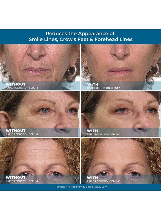 Plexaderm Rapid Reduction Eye Serum Pods - Advanced Formula - Anti Aging Serum Visibly Reduces Under Eye Bags, Wrinkles, Dark Circles, Fine Lines & Crow's Feet Instantly