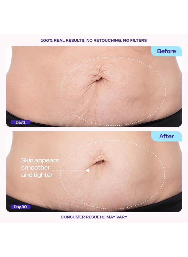 جو بيور كريم البطن الشديد والسلس - اختبر سريريًا مع مجمع MicroTight4 لتقليل مظهر علامات السيلوليت والتمدد - امتصاص سريع لبشرة أكثر سلاسة وأكثر قوة ، 4.25 أوقية - Image 3