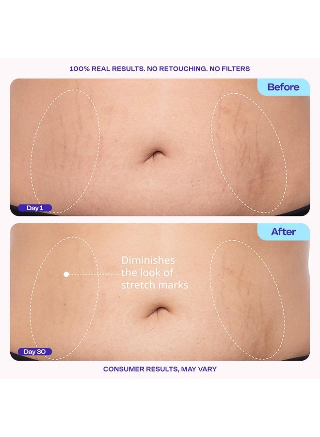 جو بيور كريم البطن الشديد والسلس - اختبر سريريًا مع مجمع MicroTight4 لتقليل مظهر علامات السيلوليت والتمدد - امتصاص سريع لبشرة أكثر سلاسة وأكثر قوة ، 4.25 أوقية - Image 5