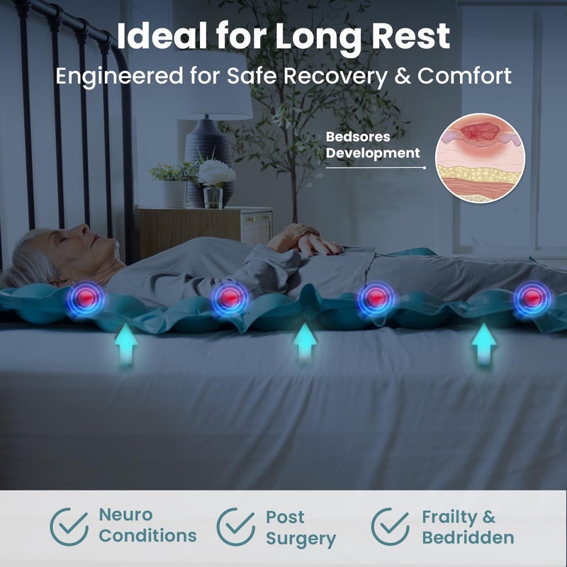 Pelegon Alternating Air Pressure Mattress Pad â€“ Hospital Bed Mattress Topper for Bedridden Patients, Pressure Relief Mattress Topper to Reduce Bed Sores, Whisper-Quiet Pump, Medical-Grade Support - Image 3