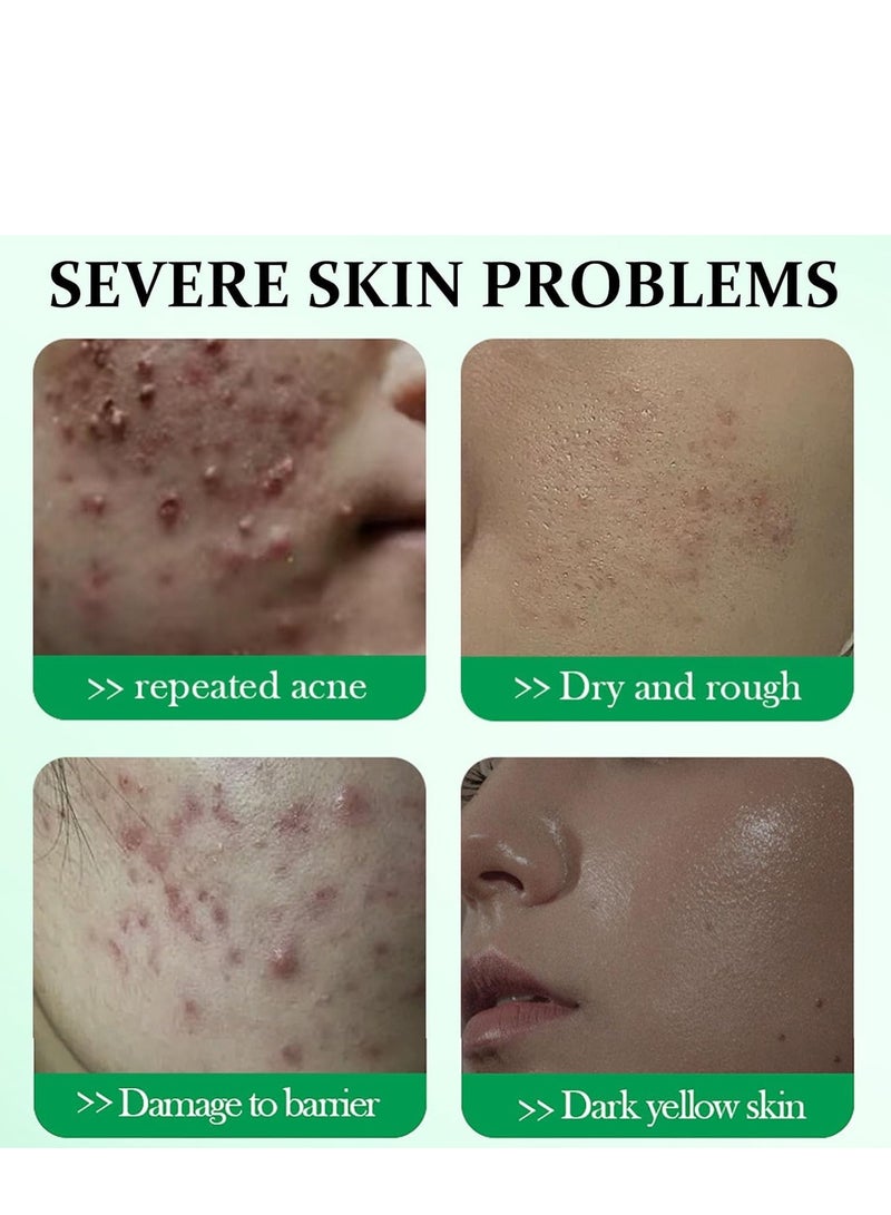 فيني جل علاج حب الشباب من شجرة الشاي ، علاج البقع للوجه ، جل مضاد لحب الشباب للبثور ، مزيل البقع الداكنة للوجه ، ترطيب للعناية بالبشرة تتلاشى بقع حب الشباب التحكم في الزيت يتقلص المسام 20 جرام - Image 2