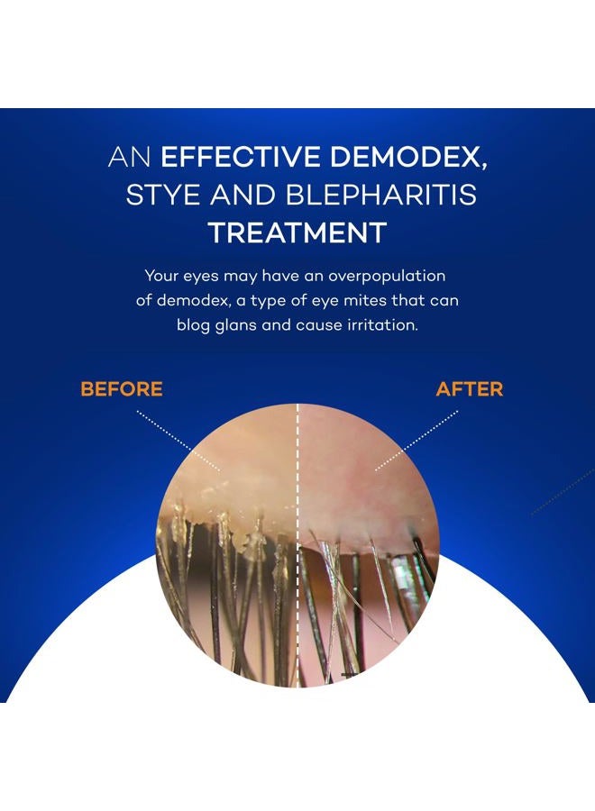 ARDELL مناديل زوكيويب للجفون مع مركب البامية الطبيعي - وسادات منظف ومرطب للجفون - مناديل تنظيف الجفون - علاج التهاب الجفون - 40 قطعة - Image 5