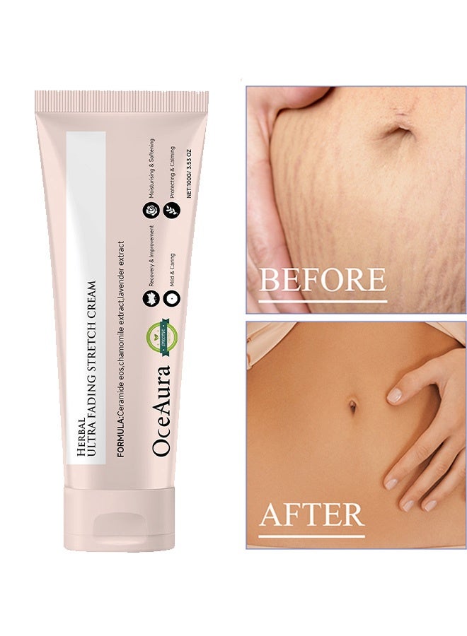 OceAura Herbal Ulera Fading Stretch Cream，Stretch Marks and Scar Removal Cream, Lighten Fat Lines and Postpartum Scars, Moisturize and Smooth Skin, Body Care Cream  100g - Image 1