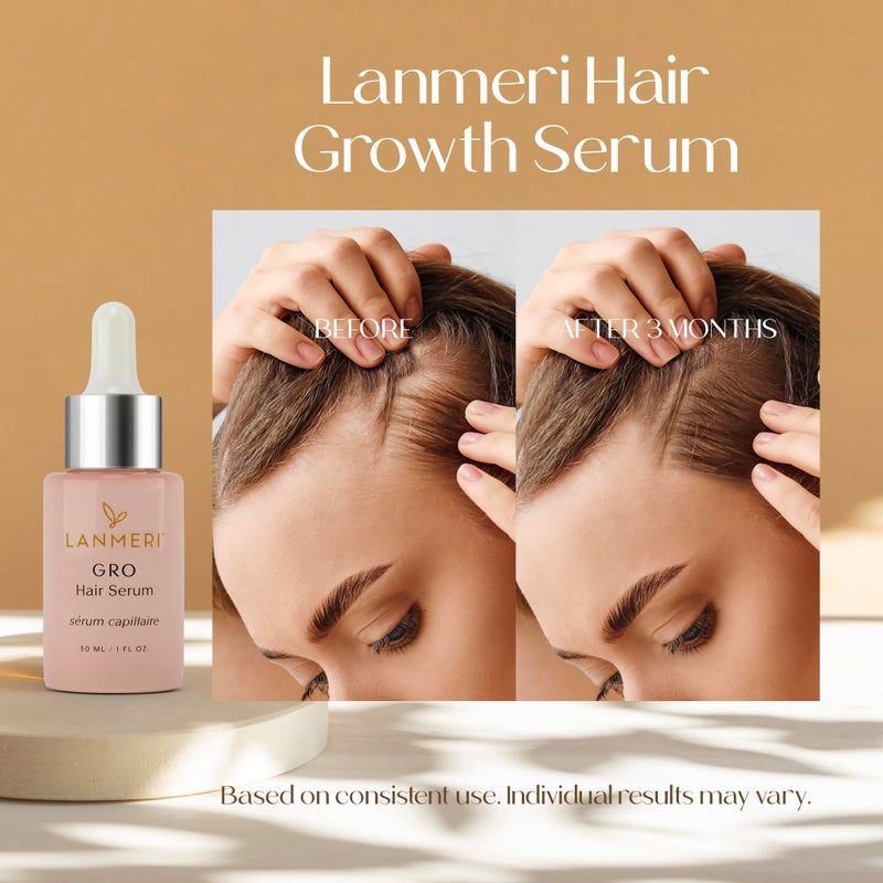 Lanmeri Vegan Hair Growth Serum for Women & Men - Natural Scalp Treatment for Thinning Hair and Hair Regrowth - Fuller-looking, Thicker and Healthier Hair in 90 Days, All Hair Types - Image 2
