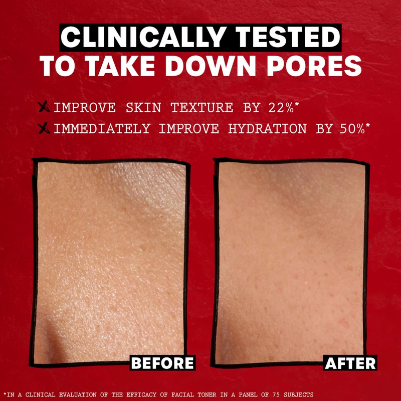 Thayers Trial Size Alcohol Free Unscented Witch Hazel Facial Toner with Aloe Vera Formula- 3 oz - Image 4