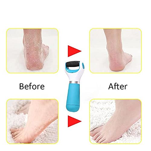 Kytaste Smooth Pedi Foot Hard Skin Remover(Multi Color,1 pc) - Image 3