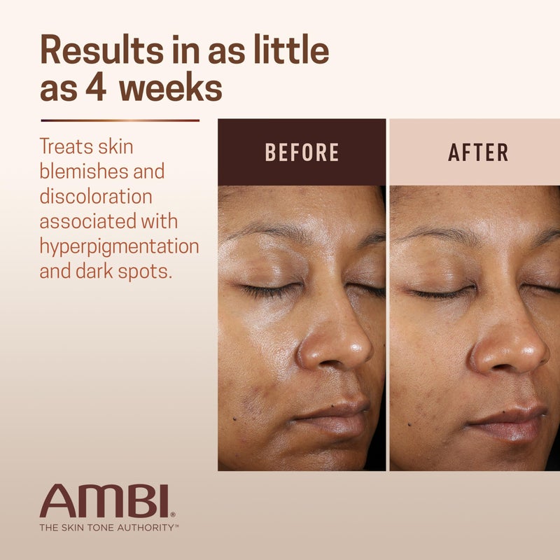 ambi كريم Ambi Even &amp; Clear Advanced Fade، خالٍ من الهيدروكينون، علاج فرط التصبغ، مصحح للبقع الداكنة العنيدة، نتائج في أقل من 2-3 أسابيع، النياسيناميد، مستخلص جذر عرق السوس، PHA، 1 أونصة سائلة - Image 4