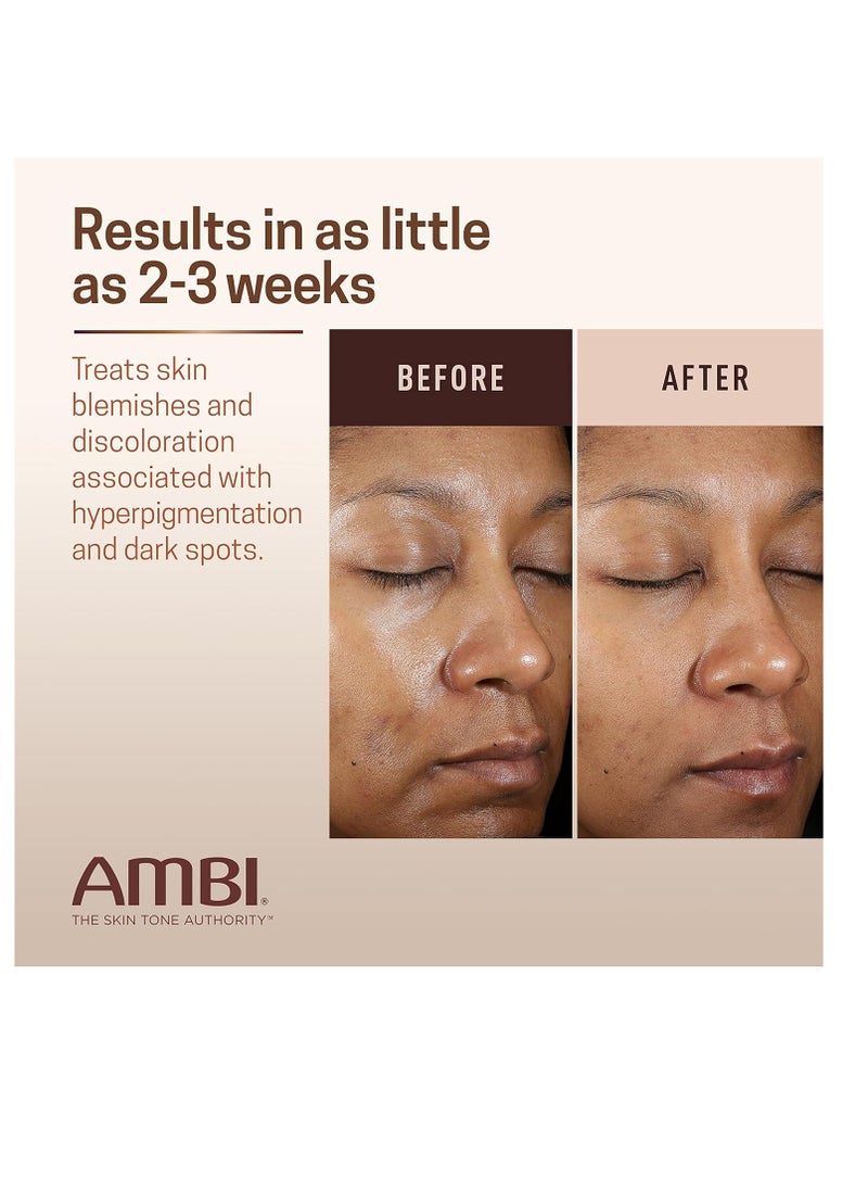 ambi - Ambi Even & Clear Advanced Fade Cream, Hydroquinone-free, Hyperpigmentation Treatment, Stubborn Dark Spot Corrector, Results In As Little 2-3 Weeks, Niacinamide, Licorice Root Extract, PHA, 1 Fl Oz - Image 1