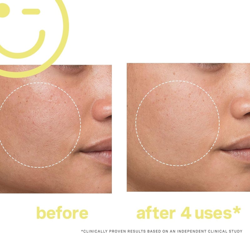 Kate Somerville Mega-C 30% Vitamin C Brightening Facial Mask â€“ Clinic-Grade Treatment to Brighten, Even Skin Tone & Firm, 2 Fl Oz - Image 5