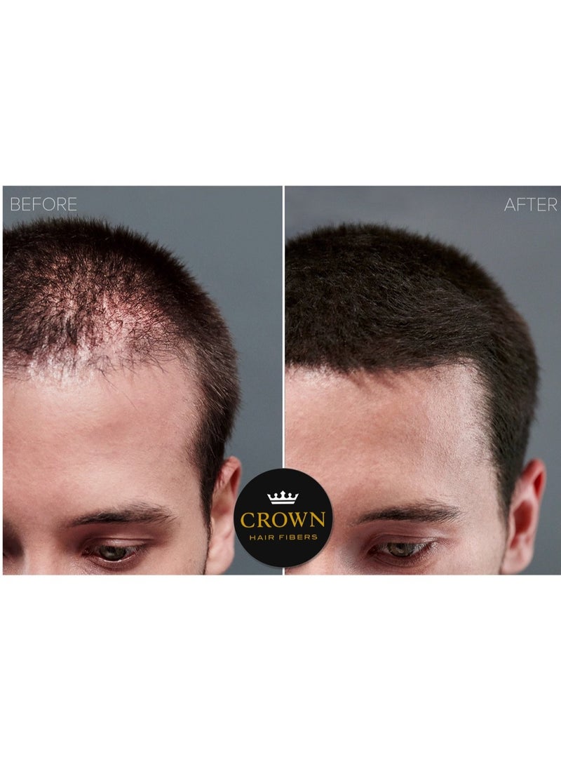 CROWN HAIR FIBERS - CROWN Hair Building Fibers for Fine & Thinning Hair (DARK BROWN) - Instantly Create Thicker Fuller Looking Hair - Best Natural Keratin Hair Loss Concealer - 13 Shades for Men & Women (0.99oz) - Image 1