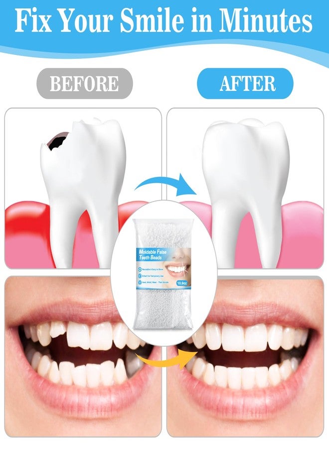 RAINFLOW 10.9oz Whiten Fitting Beads - Teeth Whitening Kit,Pellets for DIY Filling Teenth,Thermal Fitting Beads Used for Used for All Teeth Styles,Keep Smile - Image 2