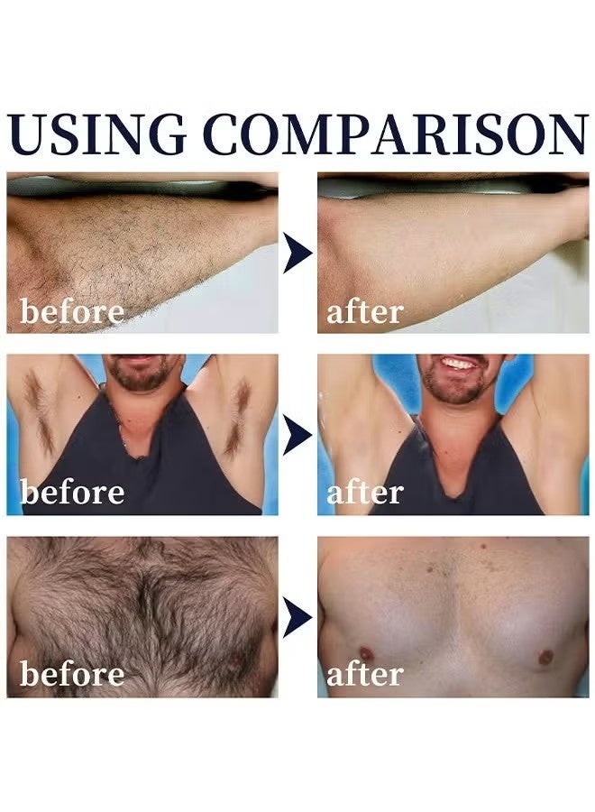 إيست مون مثالي لرعاية الرجال إزالة الشعر رذاذ الرغوة للرجال، يمنع معدل نمو شعر الجسم، وتقلص المسام، خفيفة وغير محفزة، سريعة وغير مؤلمة إزالة الشعر الفعالة في المنزل، ويتخلص من محرج شعر الجسم. - Image 4