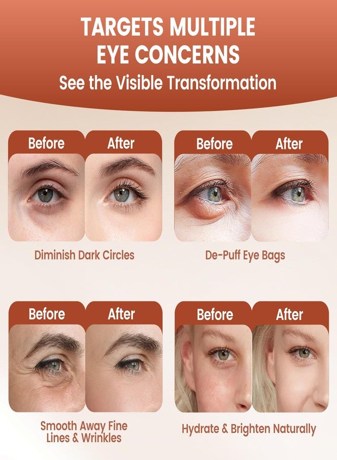 Pwkvsn Deep Peptide Collagen Eye Mask 6 Pairs, Full Eye Mask Patches with Bio-Collagen Peptide, Deep Hydrating Overnight Under Eye Patches for Dark Circles Puffy Eyes Wrinkles (1 Box/12 Patches - Image 3