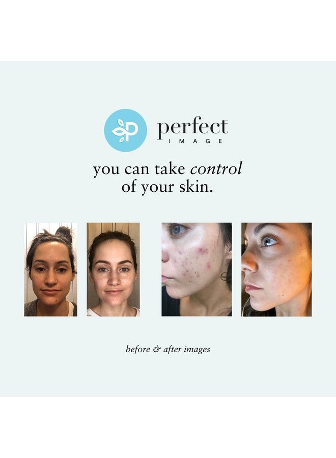 PERFECT IMAGE Perfect Image Salicylic Acid Deep Exfoliating Gel Based Cleanser, Professionally Formulated Salicylic Acid Peel Peel Prep Cleanser, Enhanced with Tea Tree Oil and Green Tea Extract - Image 4