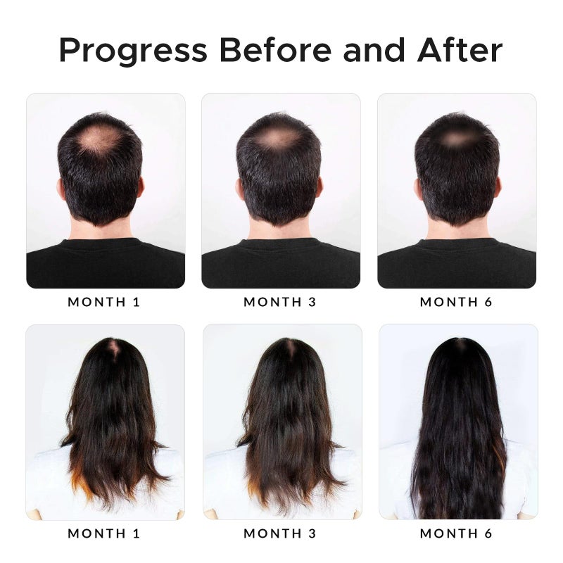 Growth Essence Minoxidil & Biotin Shampoo for Hair Growth - Enriched with Caffeine, Castor Oil & Onion - DHT Blocker for Thicker, Healthier Hair - Strengthening Formula for Men & Women - Image 4