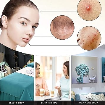 Lanjue 6 Pieces Blackhead Remover Tool Kit Stainless Steel Comedone Extractor Tweezers Acne Needle Blemish Whitehead Removal Pimple Zit Spot Popper Patches for Nose Face Skin - Image 5