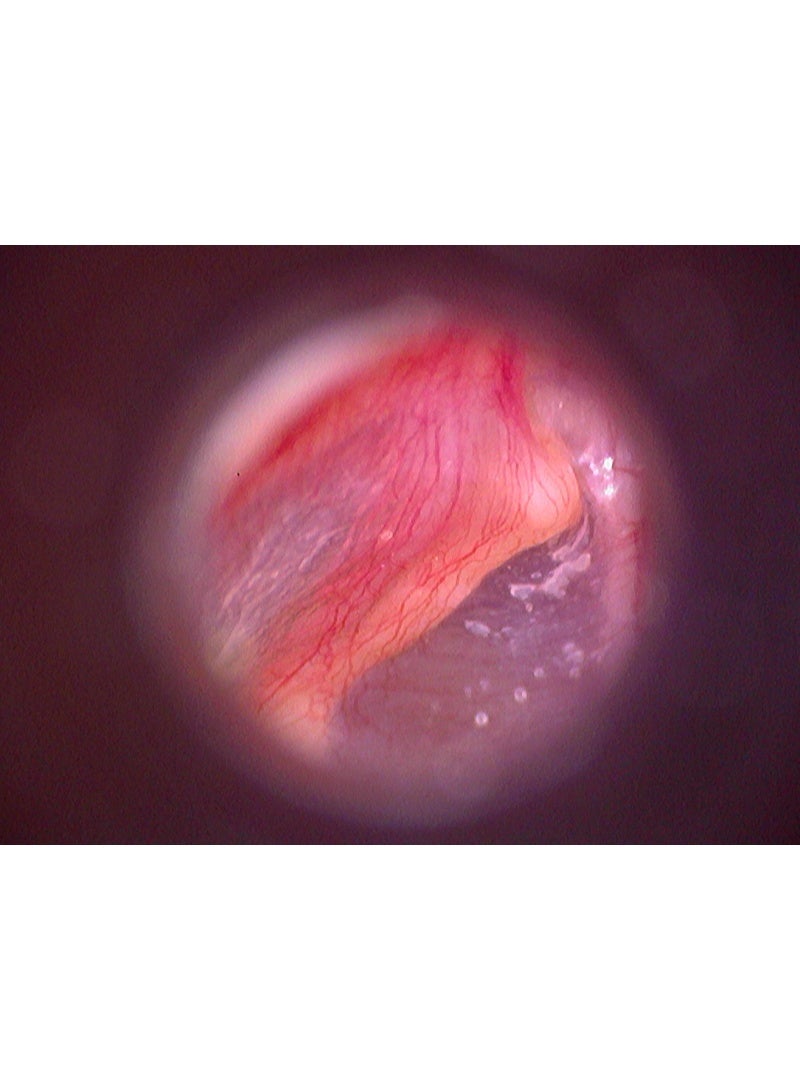 فايرفلاي منظار الأذن الرقمي المزود بفيديو منظار الأذن الرقمي المزود بفيديو Firefly DE500 هو كاميرا فيديو رقمية مخصصة، مزودة بعدسة تكبير عالية ومصابيح LED متعددة فائقة السطوع. - Image 5