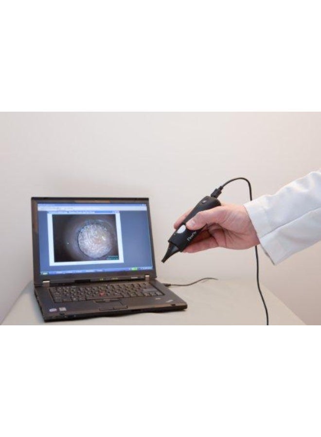 فايرفلاي منظار الأذن الرقمي المزود بفيديو منظار الأذن الرقمي المزود بفيديو Firefly DE500 هو كاميرا فيديو رقمية مخصصة، مزودة بعدسة تكبير عالية ومصابيح LED متعددة فائقة السطوع. - Image 2