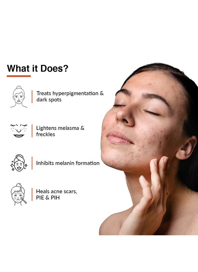 FIXDERMA - Tranexamic Acid + 2% Kojic Acid + 1% Arbutin Skarfix -Tx Face Cream | Pigmentation Removal Cream | Kojic Acid Cream | Uneven Skin Tone - 30 Gm - Image 1