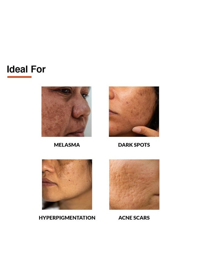 FIXDERMA - Tranexamic Acid + 2% Kojic Acid + 1% Arbutin Skarfix -Tx Face Cream | Pigmentation Removal Cream | Kojic Acid Cream | Uneven Skin Tone - 30 Gm - Image 1
