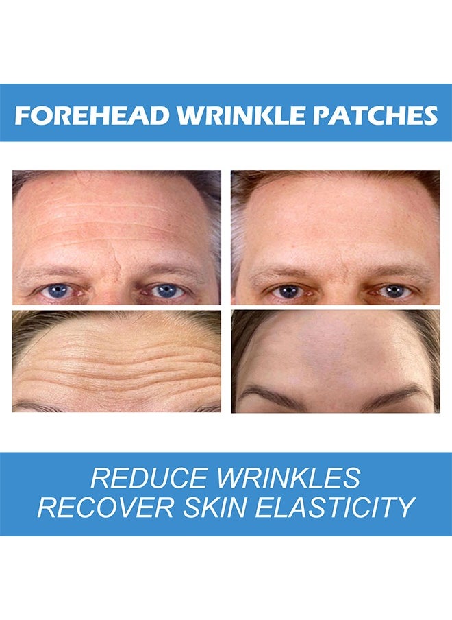 EELHOE - Forehead Wrinkle Patches 12pcs - Smooth Fine Lines & Wrinkles, Anti-Wrinkle Patches with Hydrolyzed Collagen with Aloe,Vitamin E, Anti Wrinkle Patches, Forehead Wrinkles Treatment - Image 1