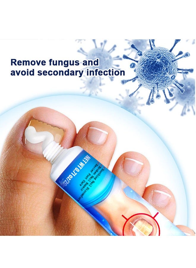 Sumifun Nail Fungus Treatment Cream 20g, Bad Nail Care Ointment, Nail Fungus Treatment, Nail Growth and Repair, Nail Treatment Repair Cream - Image 4