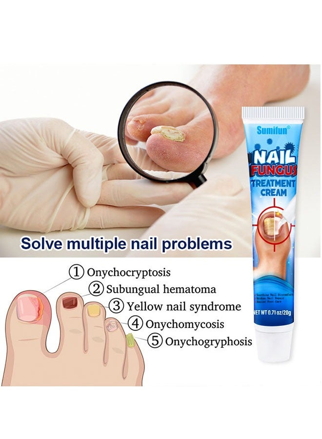 Sumifun Nail Fungus Treatment Cream 20g, Bad Nail Care Ointment, Nail Fungus Treatment, Nail Growth and Repair, Nail Treatment Repair Cream - Image 5