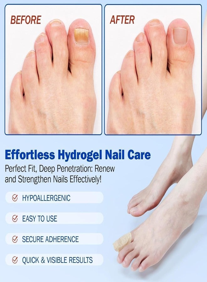 TRENDERA Fungal Nail Patch Treatment - Powerful Antifungal Solution, Effortless Hydrogel Nail Care, Overnight Nail Repair, 20 Patches - Image 5