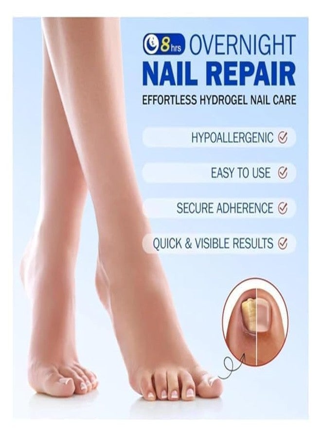 TRENDERA Fungal Nail Patch Treatment - Powerful Antifungal Solution, Effortless Hydrogel Nail Care, Overnight Nail Repair, 20 Patches - Image 2