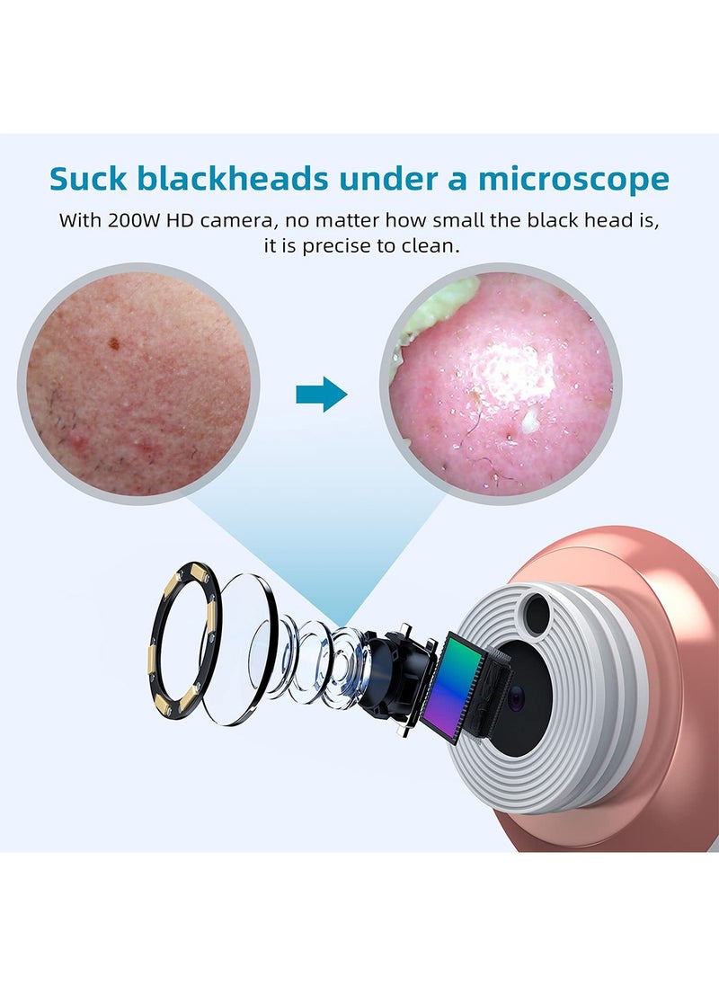 LEOKOR - Pore Cleaner with HD Camera, Electric Blackhead Suction Machine, Pimple Acne Comedone Extractor Kit with 4 Suction Heads, Smart Skin Care Tools - Image 1