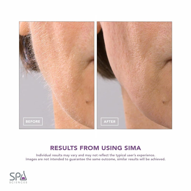 SPA SCIENCES - SIMA Patented Dermaplane Razor for Women Face – Painless 2-in-1 Facial Exfoliation & Peach Fuzz Hair Removal – Anti-Aging – 3 Speeds – Rechargeable – 7 Weeks Treatment - Image 5