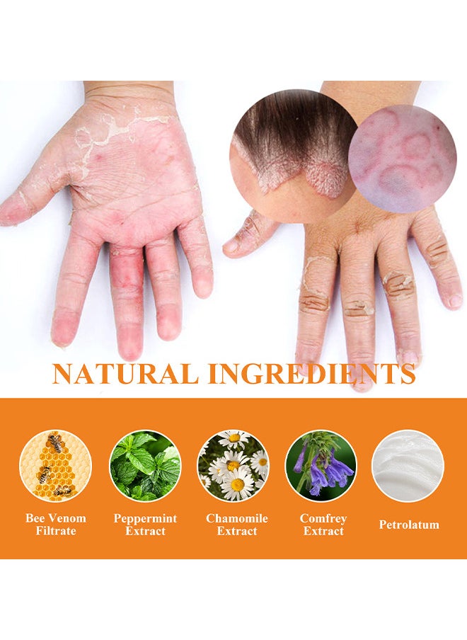 SOL LORA - Bee Venom Psoriasis Cream, New Zealand Bee Venom Professional Psoriasis Cream For Itchy Skin Fast Relief Cream For Face And Body, Soothing And Moisturizing Psoriasis Cream 20G - Image 1